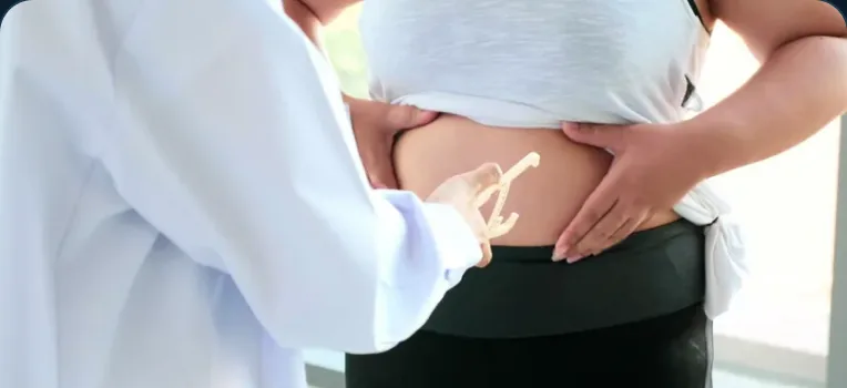 Emagrecimento e Obesidade